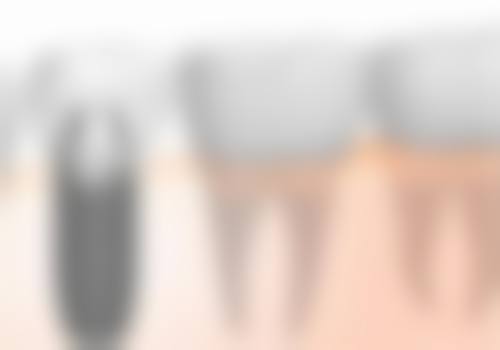 陕西汉中安朗口腔诊所特色诊疗项目与技术优势