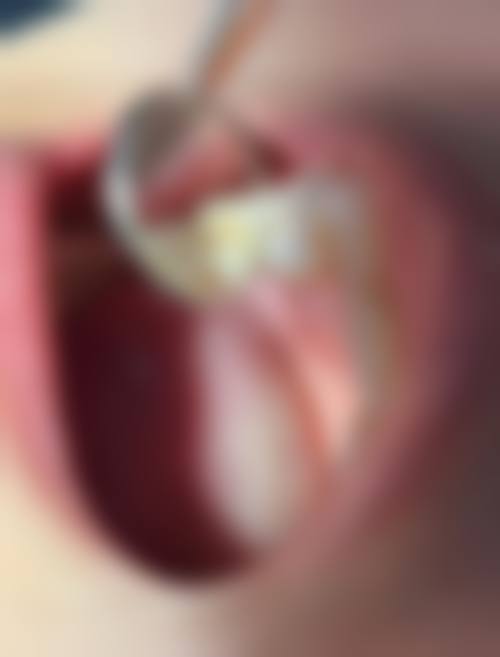 汕头朱莲口腔诊所预约挂号方式