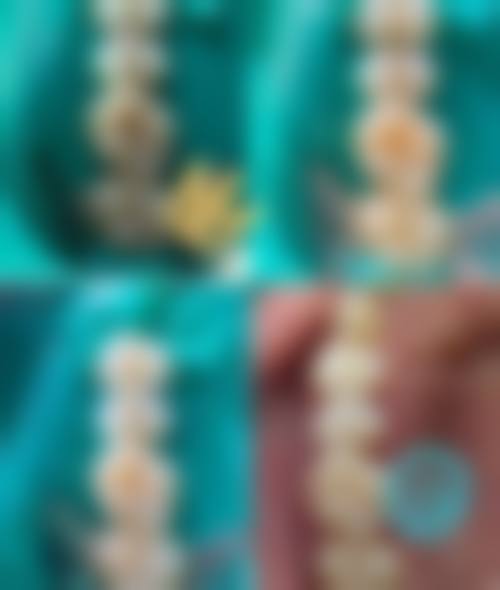 浙江绍兴诸暨牙名仕口腔收费价格表