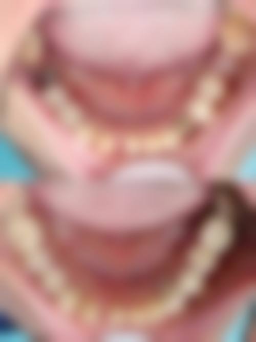 宁夏银川美康口腔收费价格表