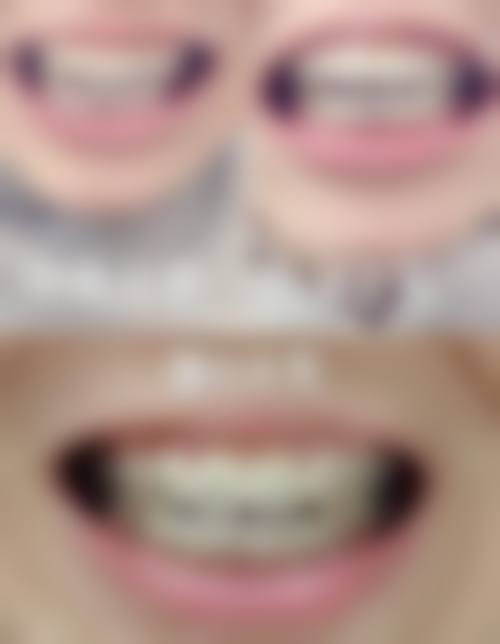 安徽亳州丽齿口腔地址电话、营业时间