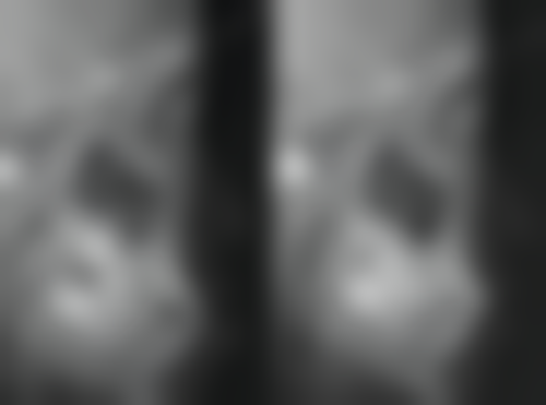 东莞市中医和西医结合医院李慧平医生项目收费价格