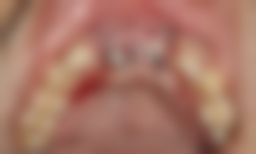 台江固德口腔门诊部预约挂号方式