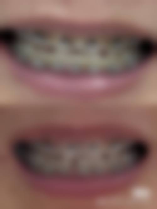 内江市第一人民医院口腔科地址电话、营业时间