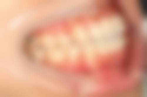 张学鹏医生预约挂号