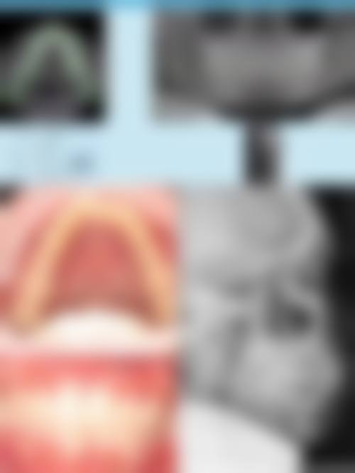 张学鹏医生技术优势