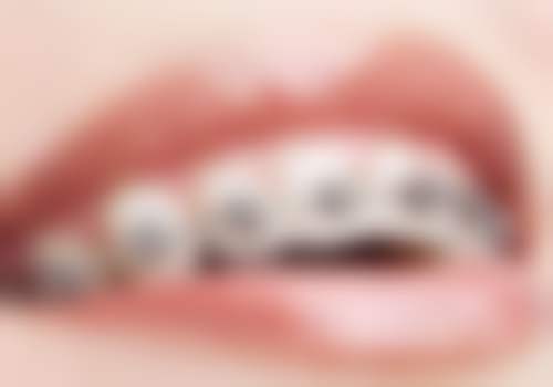 重庆正舸口腔南坪店收费价格表