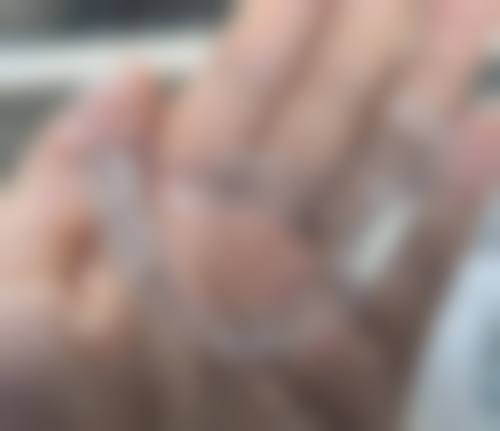 嘉兴齿尔口腔收费价格表