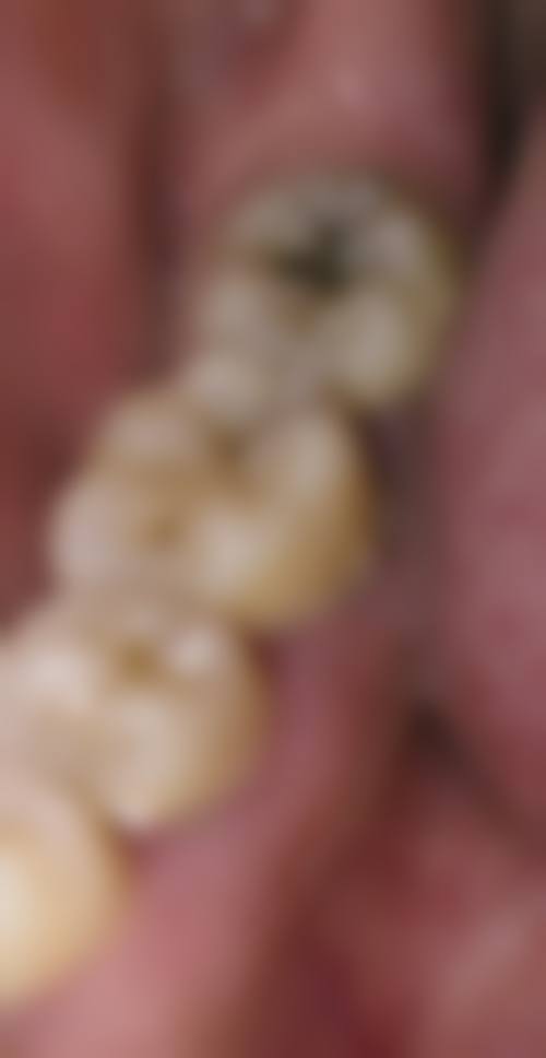 郑州美奥口腔医院收费价格表