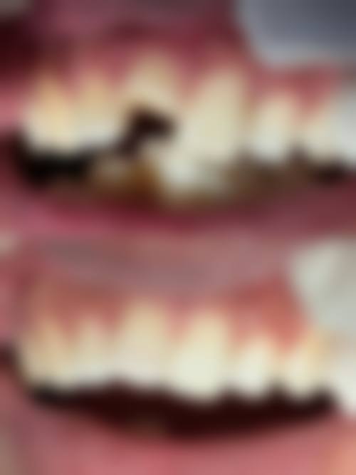 浙江杭州千岛湖启美口腔收费价格表