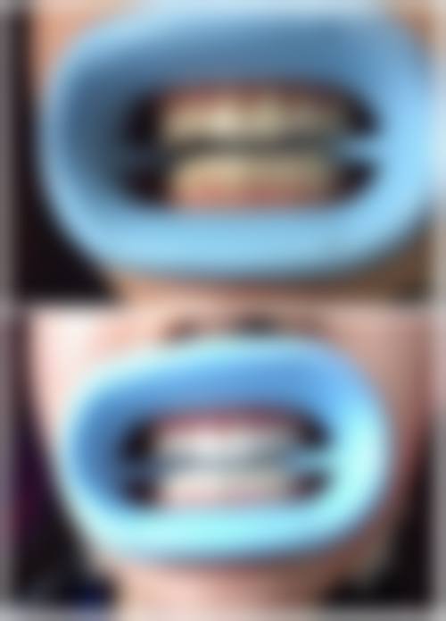 贵州遵义康贝口腔门诊部预约挂号方式