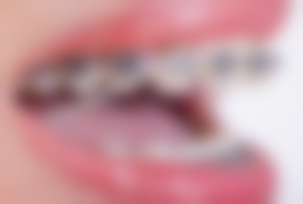 济宁凤华口腔预约挂号方式