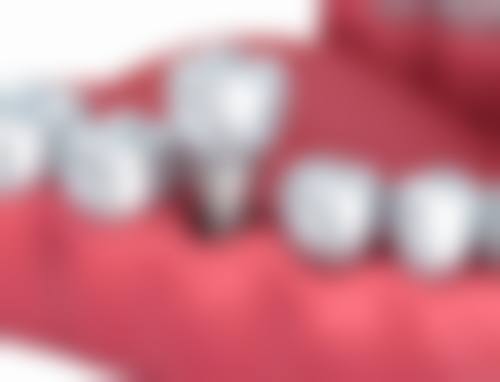 广东广州一天口腔门诊部收费价格表