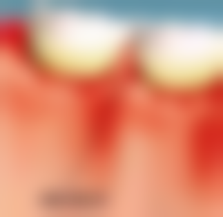 宁夏回族自治区人民医院李慧平医生个人资料简介