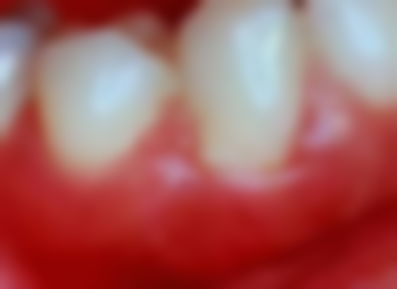 邓文娟医生技术优势