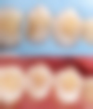 潜江迪伦口腔诊所收费价格表