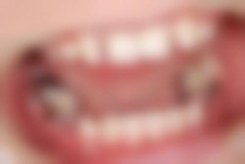 张淑婷医生口碑评价及反馈内容