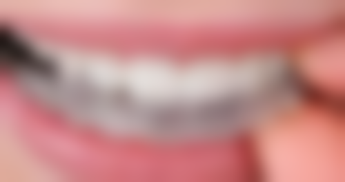 张淑婷医生项目收费价格