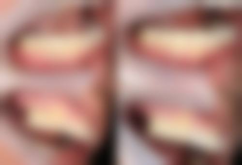 泉州泉港峰尾优牙口腔预约挂号方式