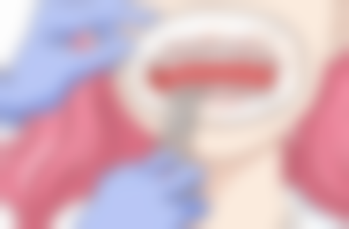 菏泽医学专科学校附属医院李慧平医生技术优势