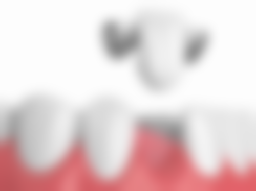 国内人民解放军成都军区总医院胡玥医生技术优势