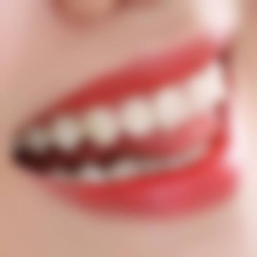 贵州黔南都匀阳光口腔诊所收费价格表