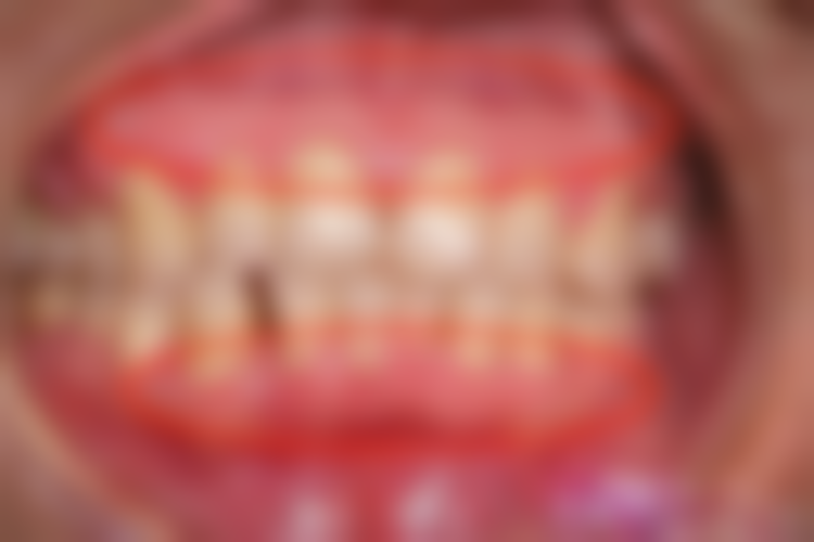 宁夏回族自治区人民医院李慧平医生执医荣誉