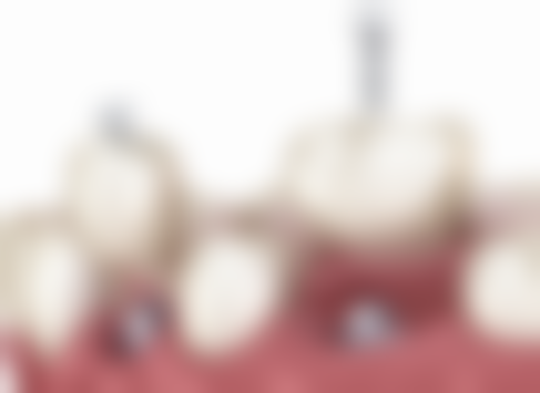 武汉壹加壹口腔医院特色诊疗项目与技术优势