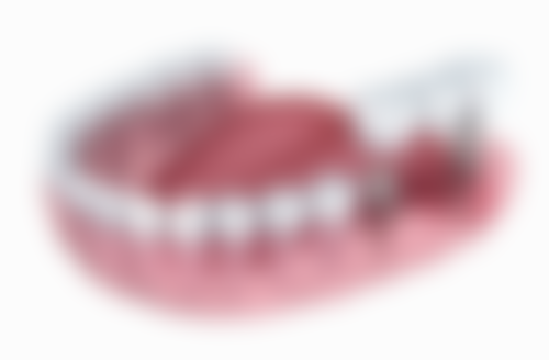 黔西 南牙管家口腔医院收费价格表