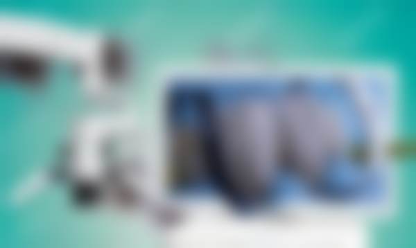 曲献文医生项目收费价格