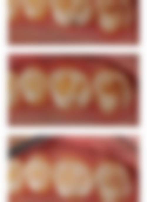 徐州新健康医院口腔科预约挂号方式