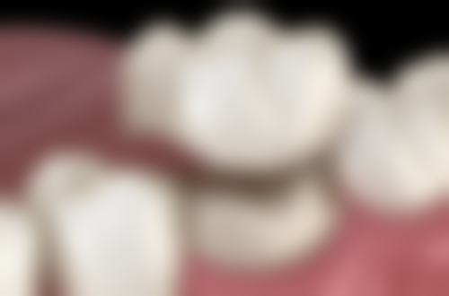 张淑婷医生技术优势