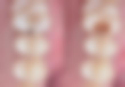 张淑婷医生执医荣誉