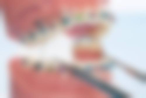 陈梦娅医生技术优势