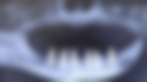 武汉大众口腔(大华门诊)特色诊疗项目与技术优势