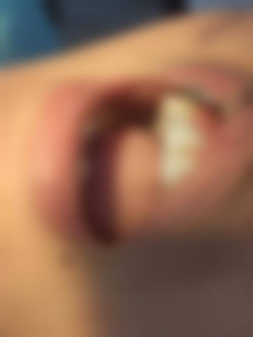 湖南益阳赫山秀园口腔预约挂号方式