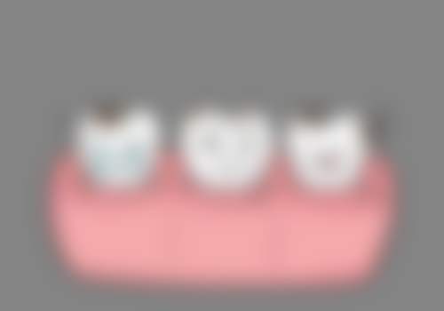 福州维乐口腔（中泽王庄店）收费价格表