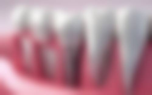 深圳林灼苗口腔诊所特色诊疗项目与技术优势