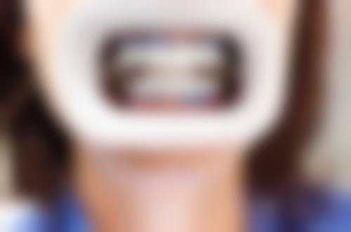 赵蔚琳医生项目收费价格