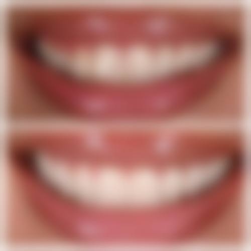 黄淑英医生预约挂号