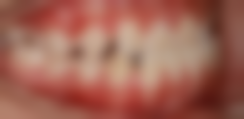 邱晓燕医生项目收费价格