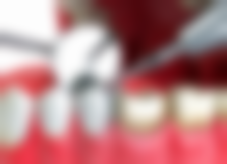 邱晓燕医生项目收费价格