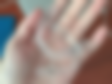 马焕医生项目收费价格