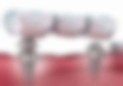 吴忠市利通区潘静口腔地址电话、营业时间