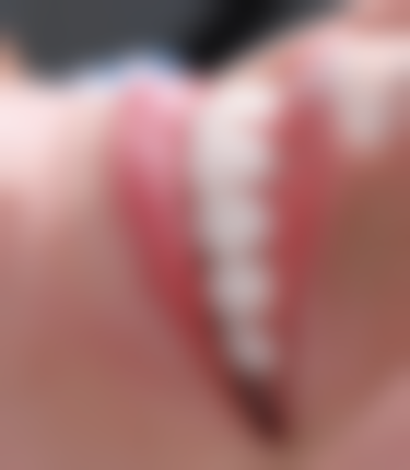 新疆乌鲁木齐美奥口腔收费价格表