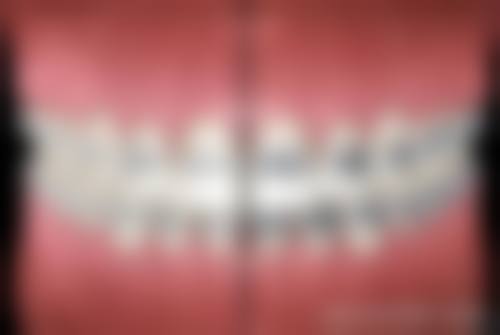 曾格医生项目收费价格