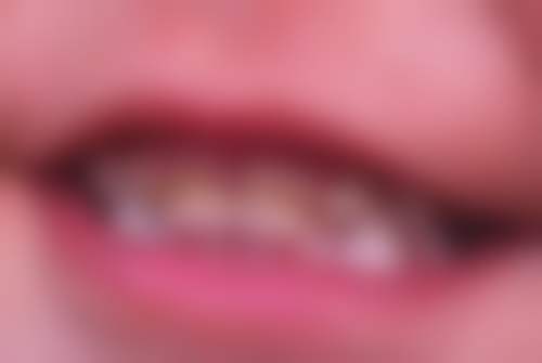 乌鲁木齐品杰口腔门诊部特色诊疗项目与技术优势