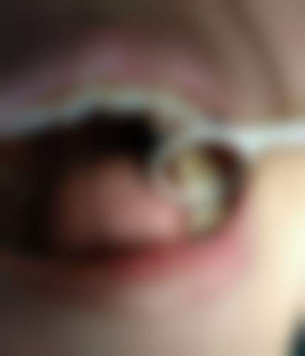 南充美健口腔诊所更擅长什么手术