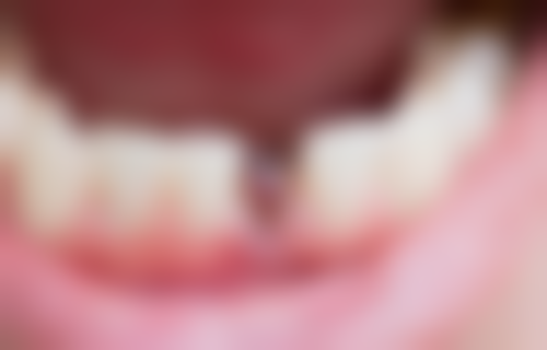 临沂市河东区口腔病防治所地址电话、营业时间