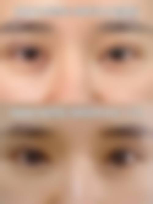 宁波同仁医院腋臭整形科治疗反馈与口碑评价。